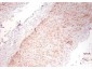 Anti-Human TNF alpha (RABBIT) Antibody
